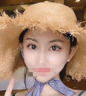 爱思特医院正规吗？医院医生的简介+相关案例展示