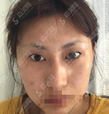 爱思特医院正规吗？医院医生的简介+相关案例展示